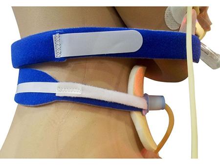 Tracheostomy Tube Holders for Stabilization