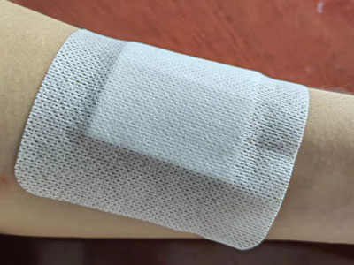 Sterile Adhesive Device for Cannula Fixation